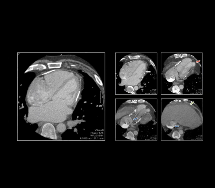 CME-Nav-Cardiac-CTA710-x-620-px